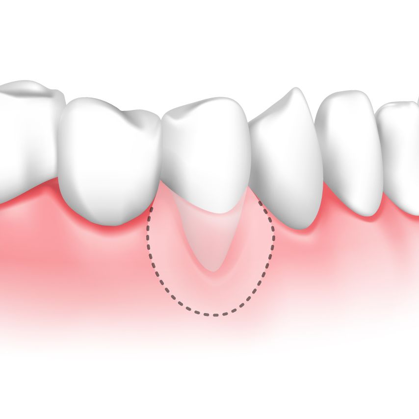 Illustration of red gums