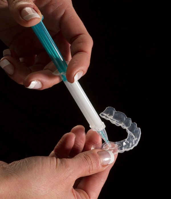 Photo of a woman placing teeth whitening gel into a custom tray
